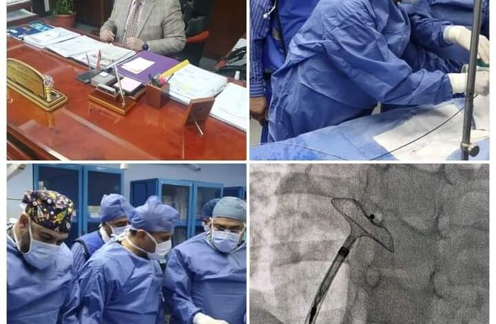 نجاح مستشفى الكهرباء فى إصلاح عيب خلقى بالقلب لطفلة عمرها 5 سنوات