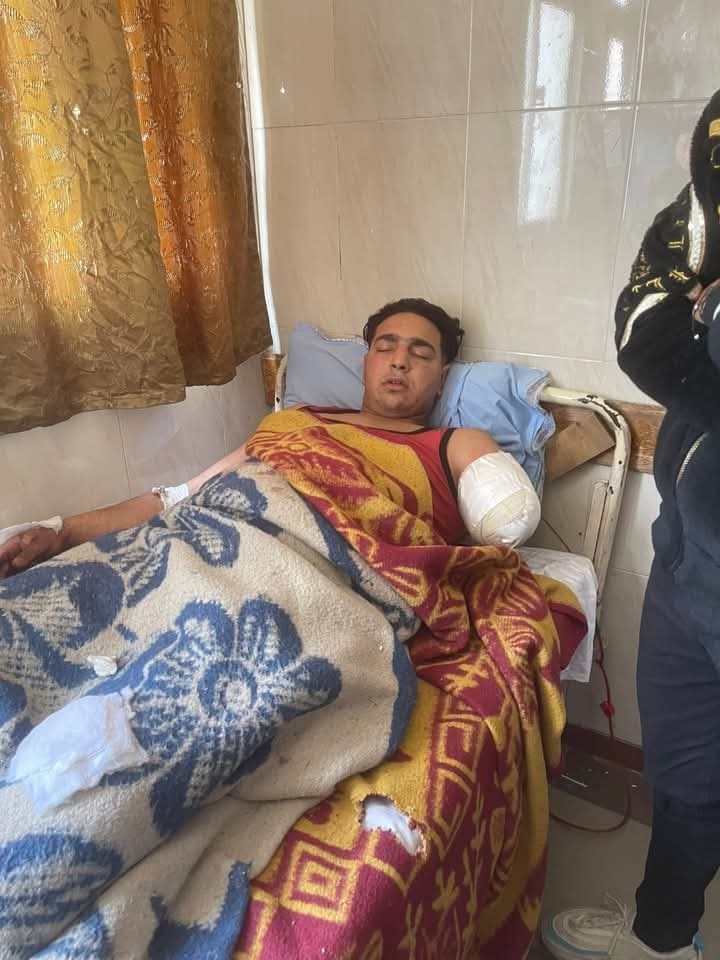 الشناوي : إدارة السيرك ضحت بذراع العامل من اجل مليون جنيه