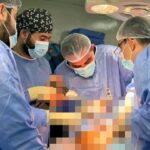 **تدريسي في كلية طب المستنصرية يقوم باجراء عملية رفع ورم عظمي من أسفل عظم القصبة لمريض في مستشفى اليرموك التعليمي**