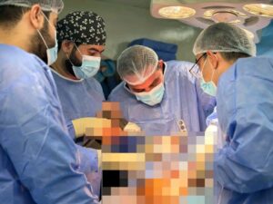 **تدريسي في كلية طب المستنصرية يقوم باجراء عملية رفع ورم عظمي من أسفل عظم القصبة لمريض في مستشفى اليرموك التعليمي**
