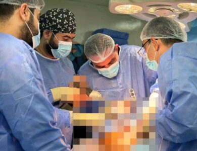 **تدريسي في كلية طب المستنصرية يقوم باجراء عملية رفع ورم عظمي من أسفل عظم القصبة لمريض في مستشفى اليرموك التعليمي**