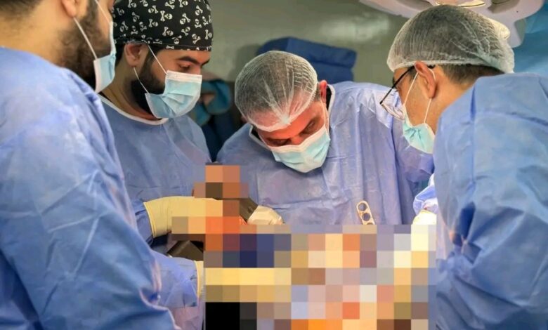 **تدريسي في كلية طب المستنصرية يقوم باجراء عملية رفع ورم عظمي من أسفل عظم القصبة لمريض في مستشفى اليرموك التعليمي**