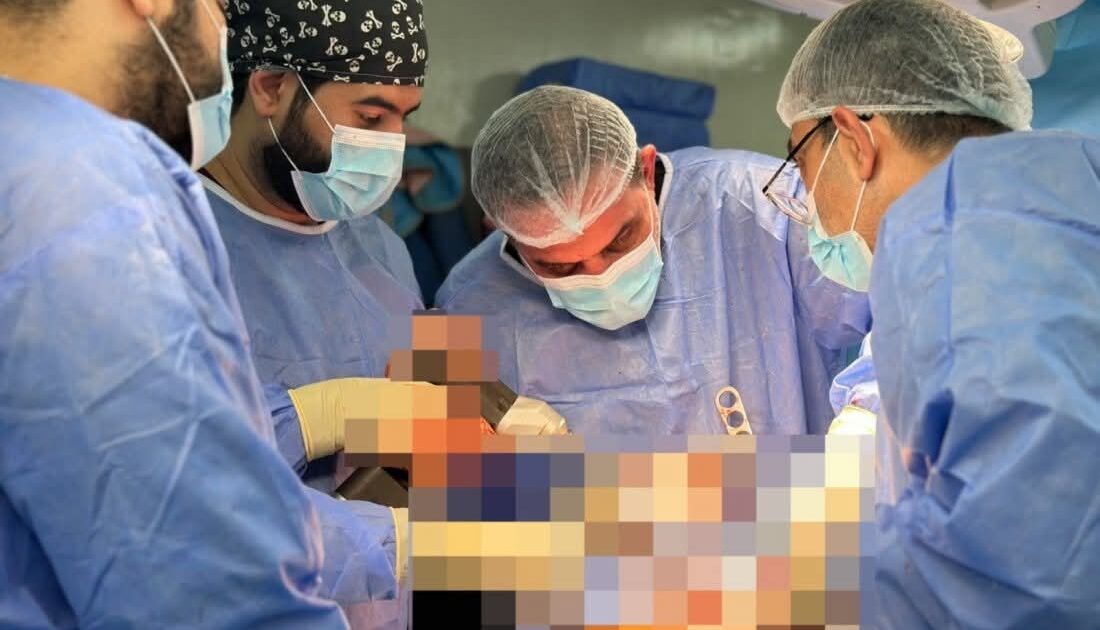 تدريسي في كلية طب المستنصرية يجري عملية تبديل مفصلي الركبتين لمريض 