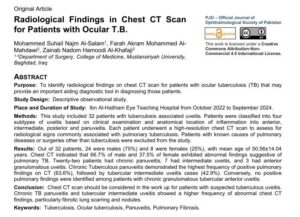 كلية طب المستنصرية ينشرون بحث علمي حول النتائج الإشعاعية للمرضى سل العين 