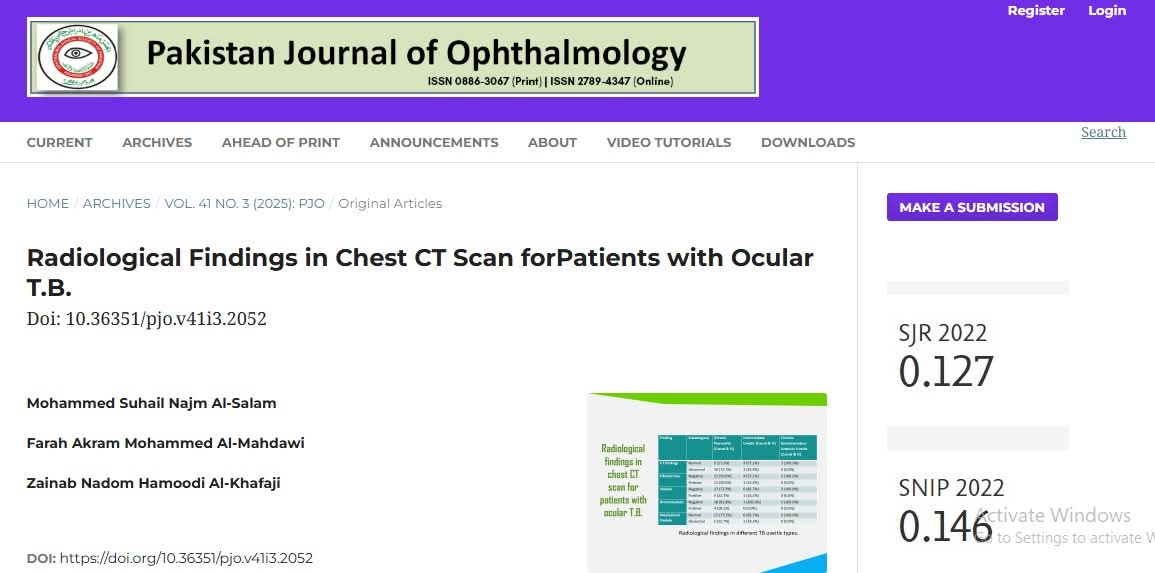 كلية طب المستنصرية ينشرون بحث علمي حول النتائج الإشعاعية للمرضى سل العين 