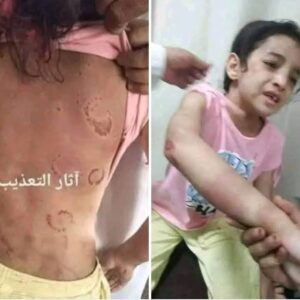منة العبد تكتب عن فقد الإحساس والضمير والرحمة