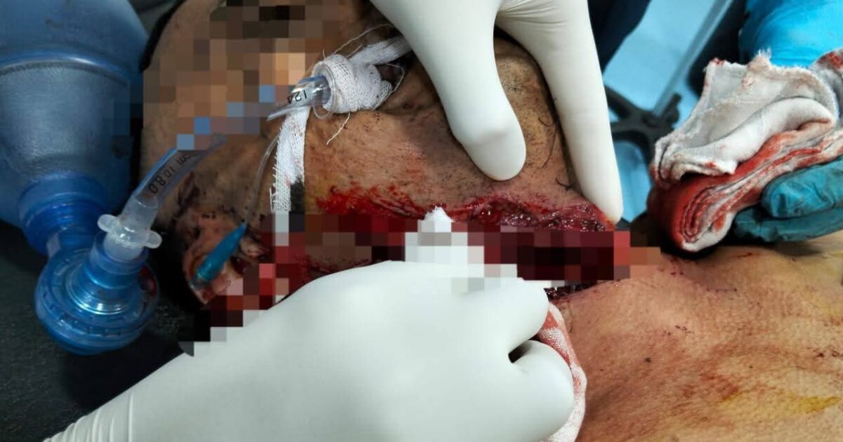 صحة البحيرةاستمرار تنفيذ الجراحات المتقدمةالعاجلة لإنقاذ حالات الطوارئ 