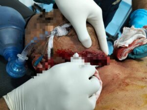 صحة البحيرةاستمرار تنفيذ الجراحات المتقدمةالعاجلة لإنقاذ حالات الطوارئ 