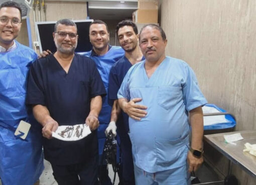 استخراج 100 مسمار وصامولة من معدة مريض بالمنظار في مستشفيات جامعة بني سويف كتب: حمدي صابر