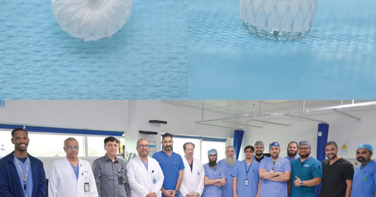 مدينة الملك عبدالله الطبية بمكة تنجح في زراعة سدادة قلبية متقدمة بالقسطرة لمريضة بالرجفان الأذيني