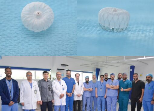 مدينة الملك عبدالله الطبية بمكة تنجح في زراعة سدادة قلبية متقدمة بالقسطرة لمريضة بالرجفان الأذيني